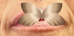 Before Image: Lip Augmentation by: Sarah