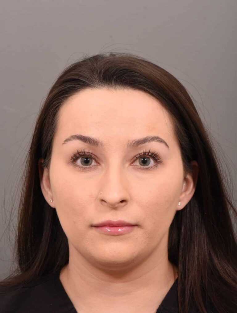 Before Image: Rhinoplasty Dr. Manning - front