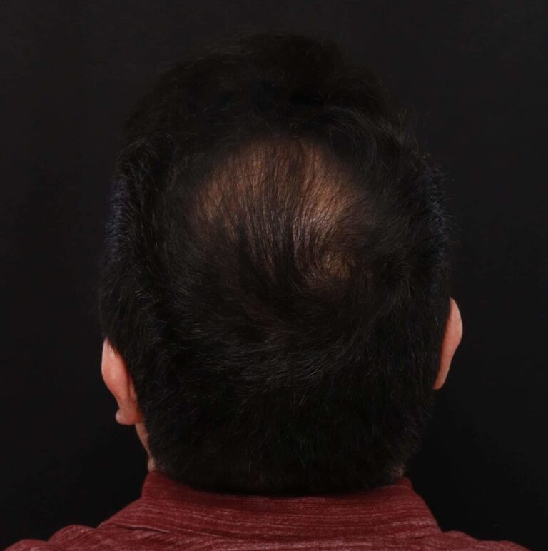 Before Image