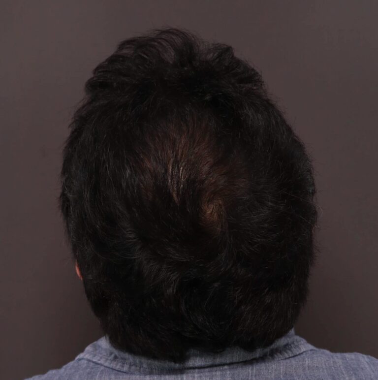 After Image