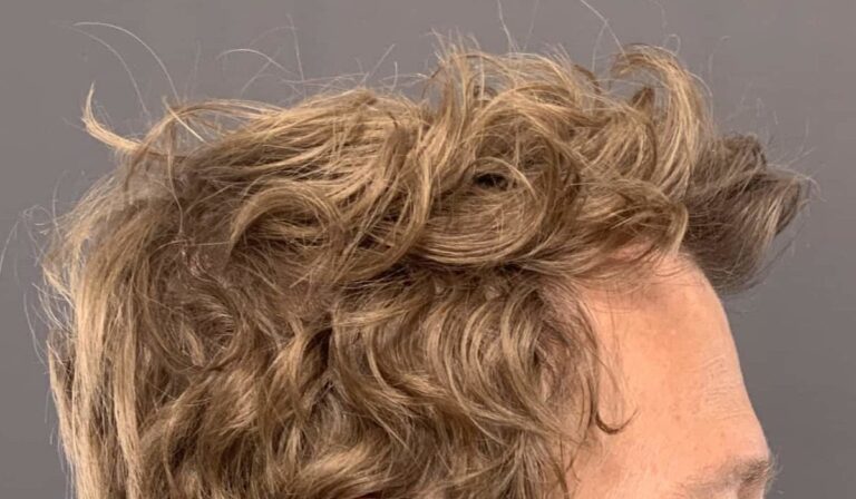 Before Image