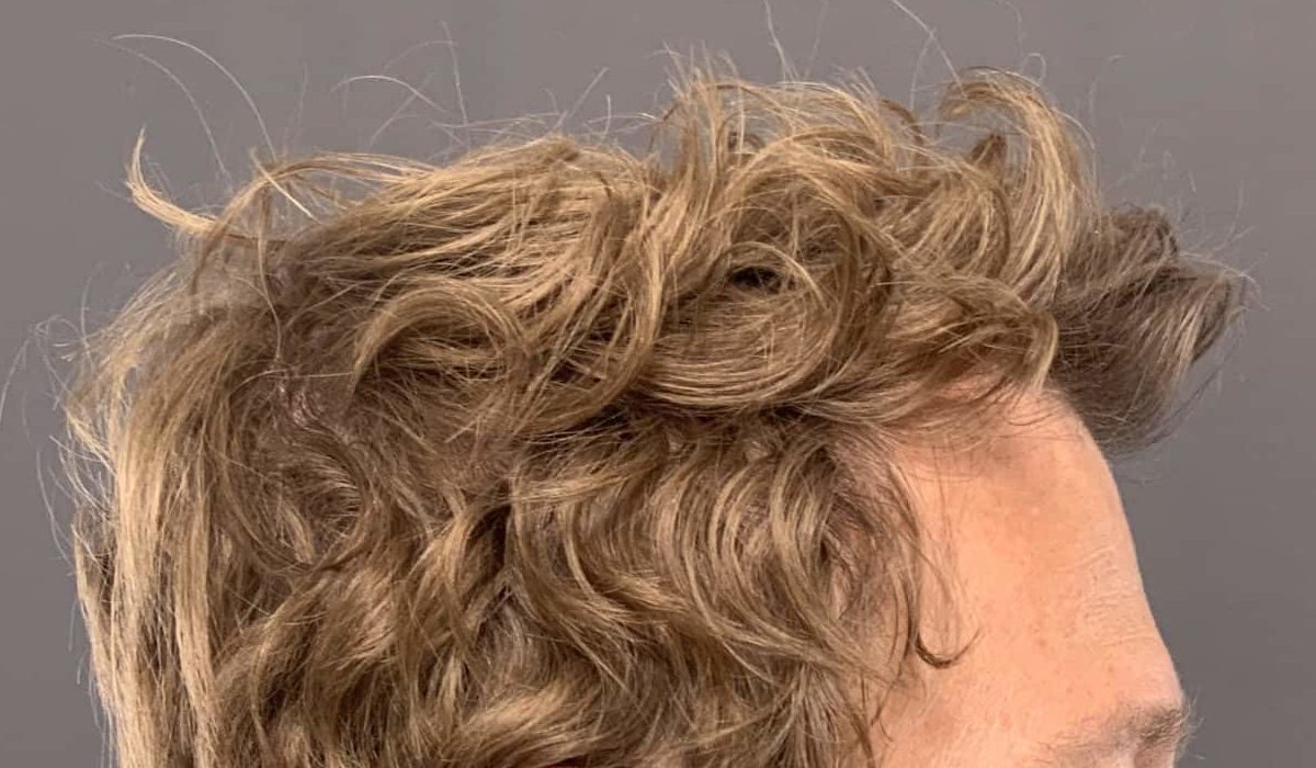Before Image