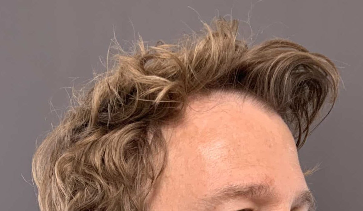 Before Image