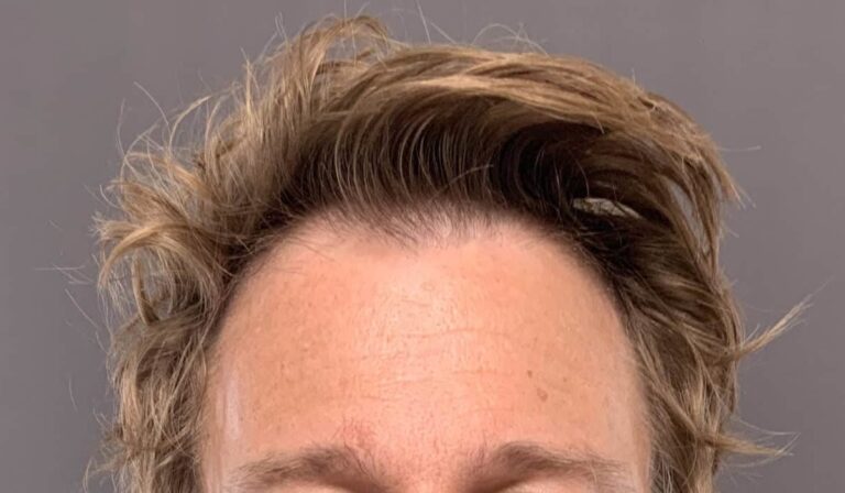 Before Image