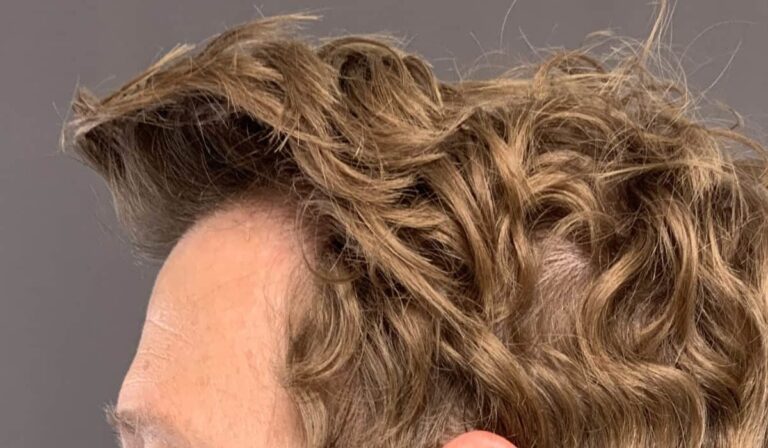 Before Image
