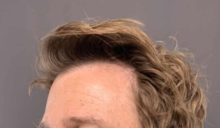 Before Image