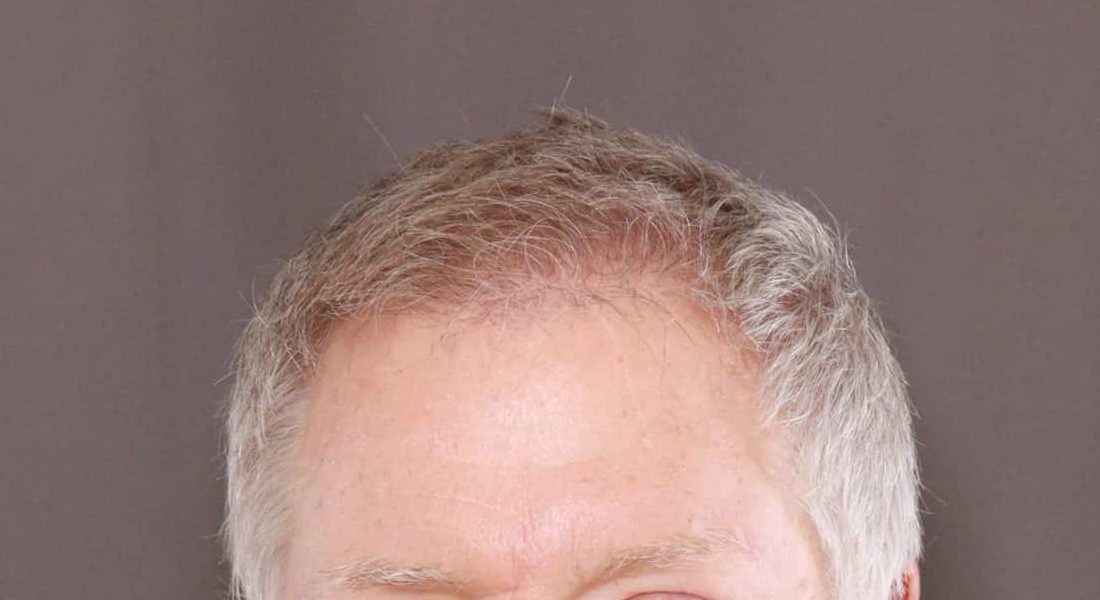 After Image