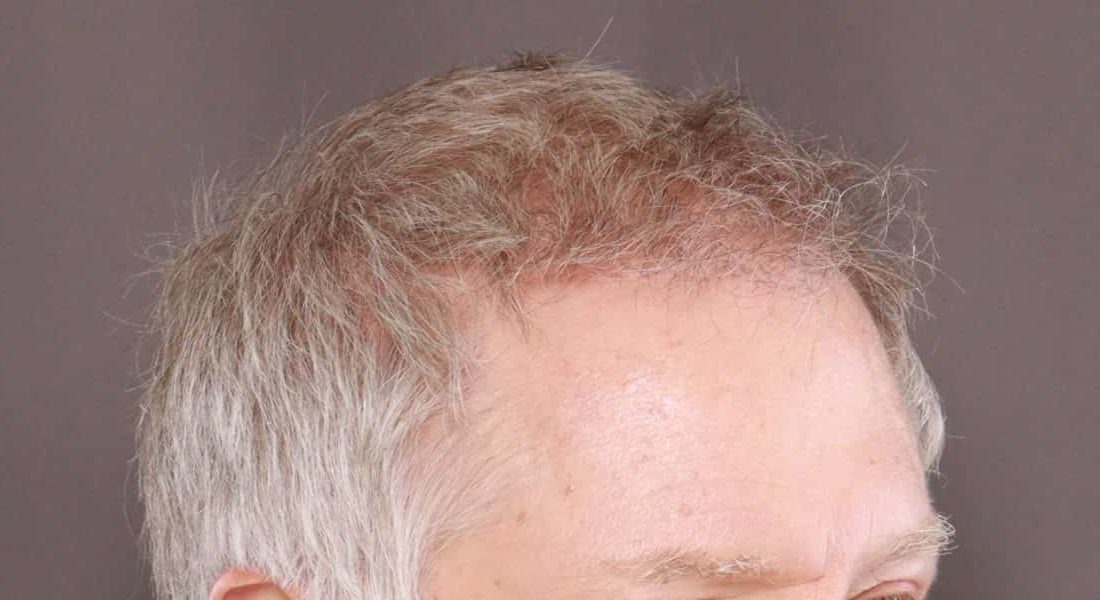 After Image