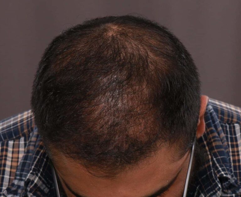 After Image