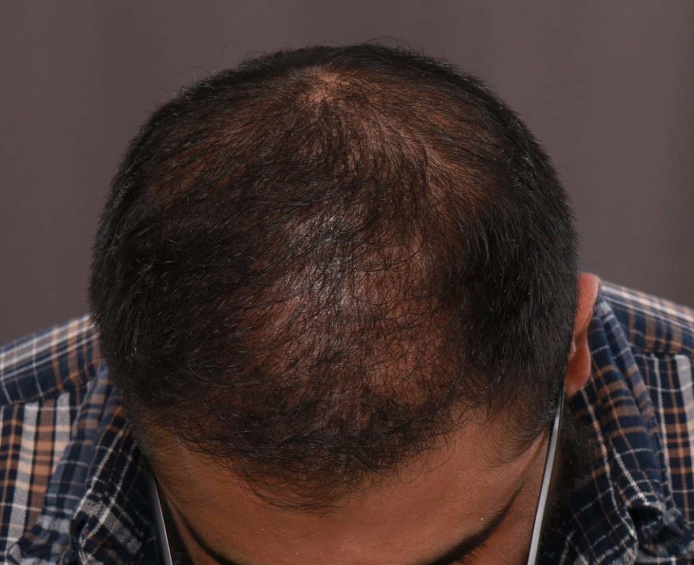 After Image