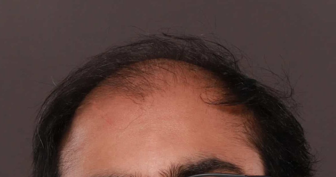 Before Image