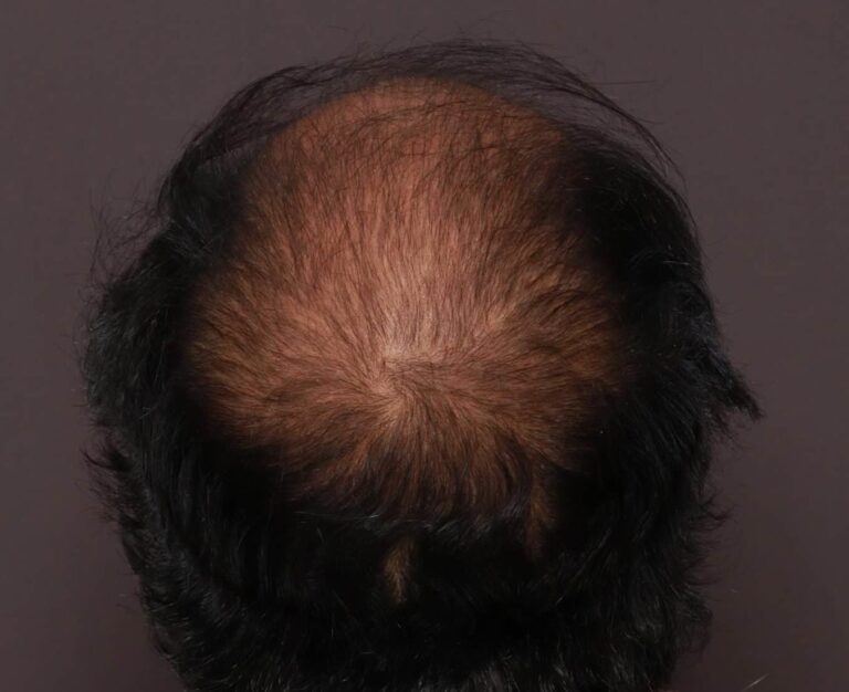 Before Image