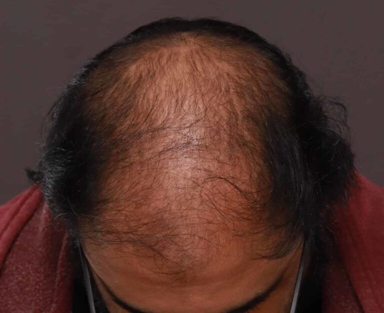 Before Image