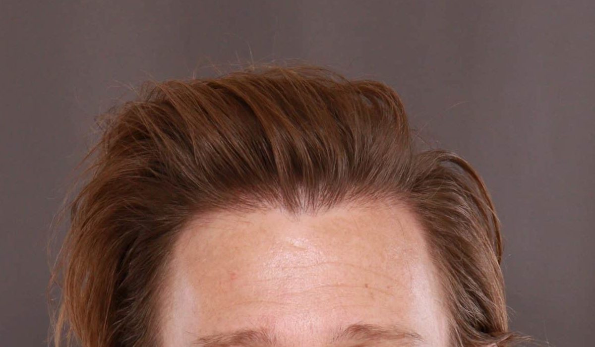 After Image