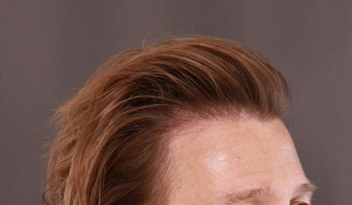 After Image