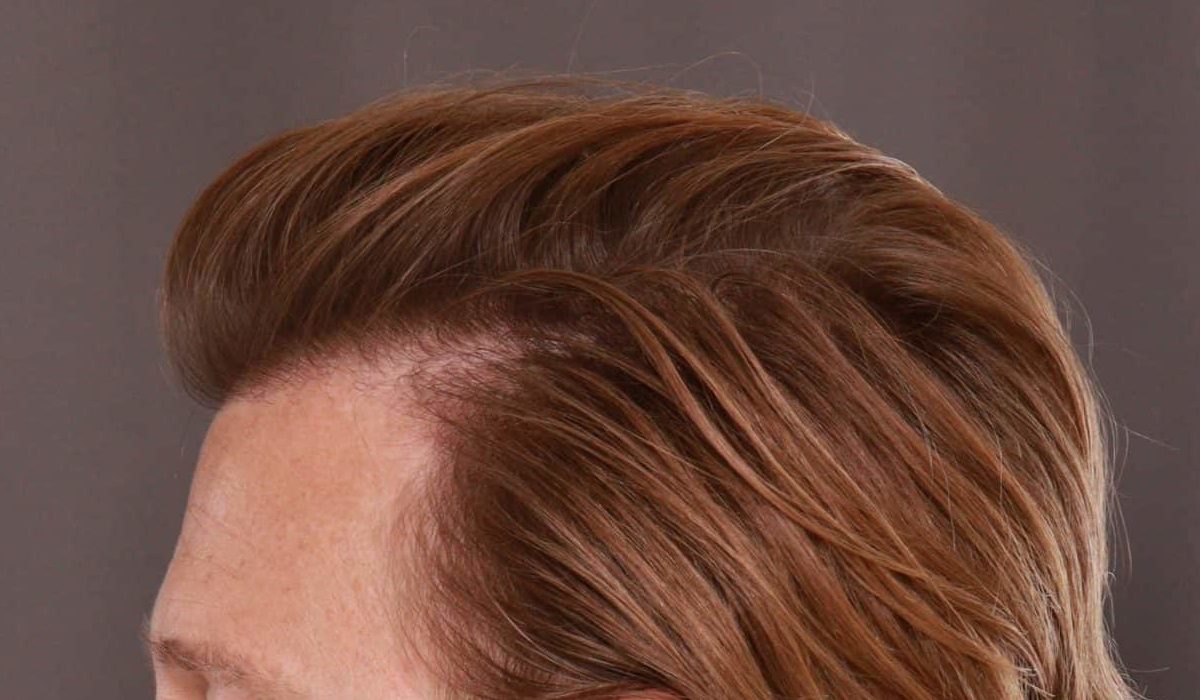 After Image