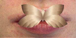 Lip Augmentation by: UFP Nurse Injector