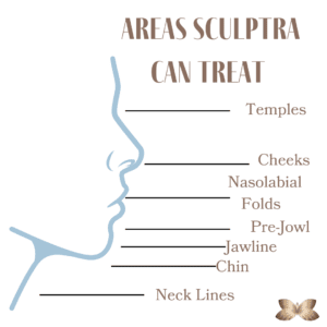 Sculptra