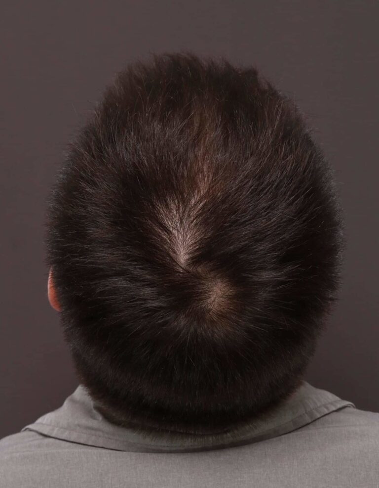 Before Image