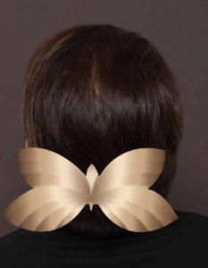 Hair Injection Therapy by: UFP Nurse