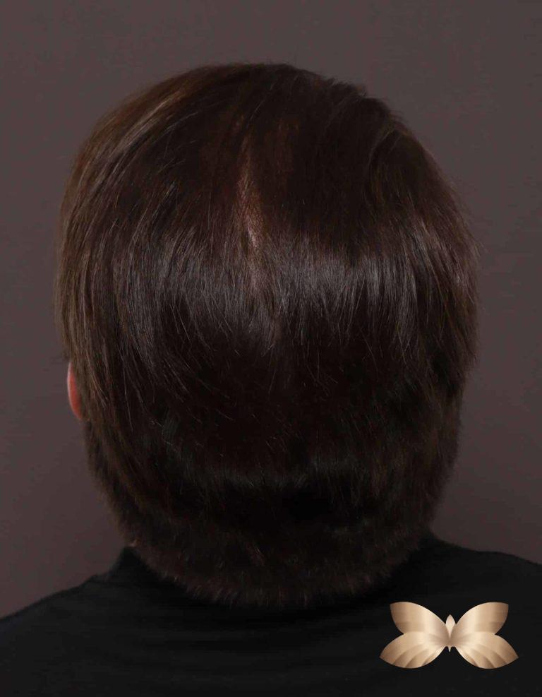 After Image