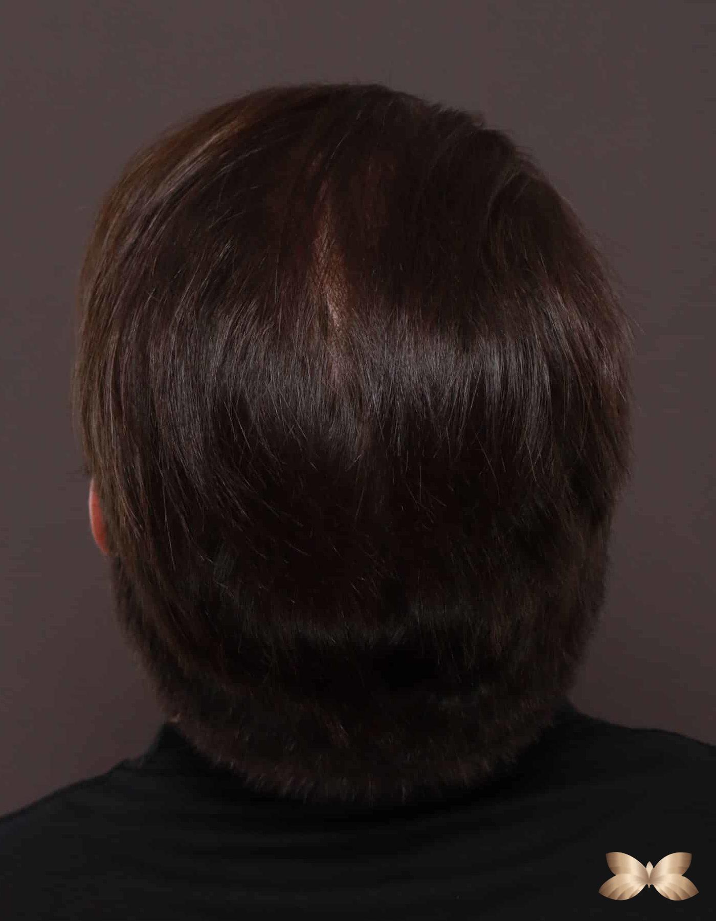 After Image