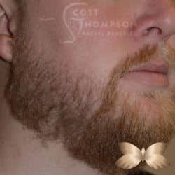 After Image