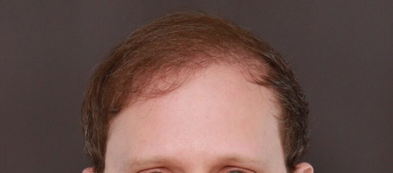 After Image