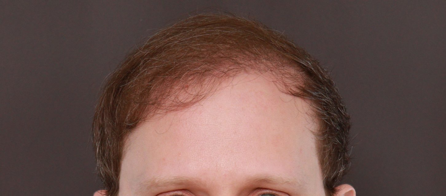 After Image