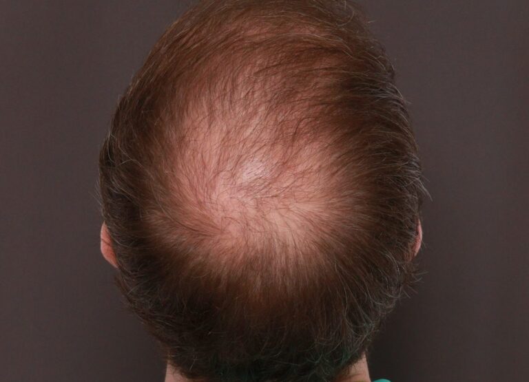 After Image