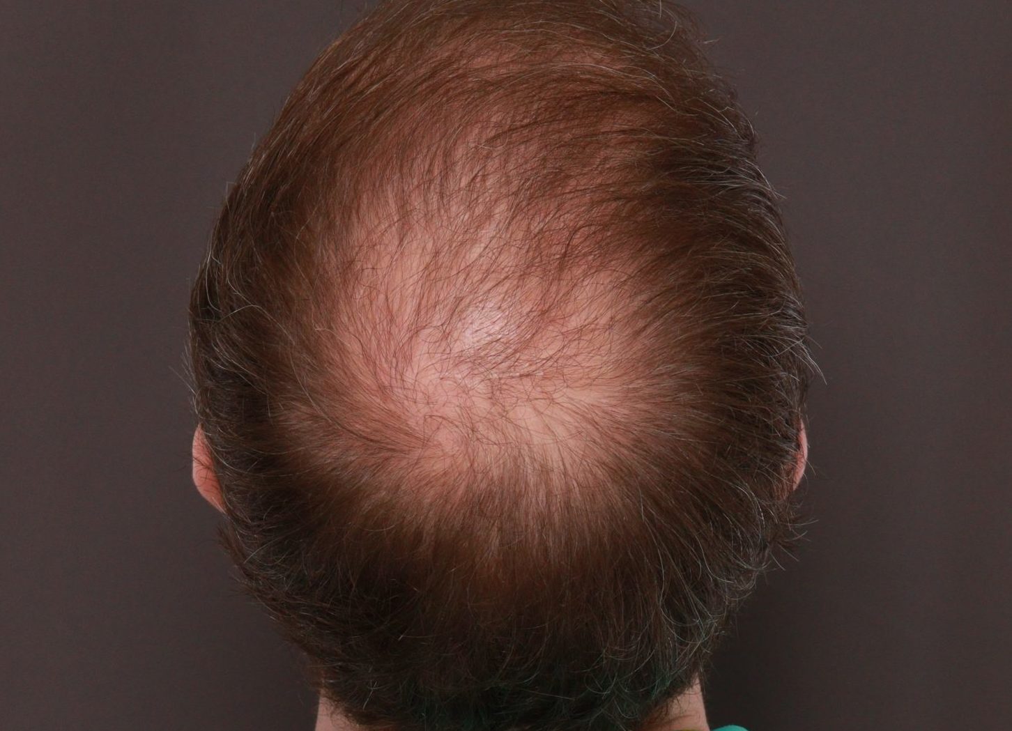 After Image