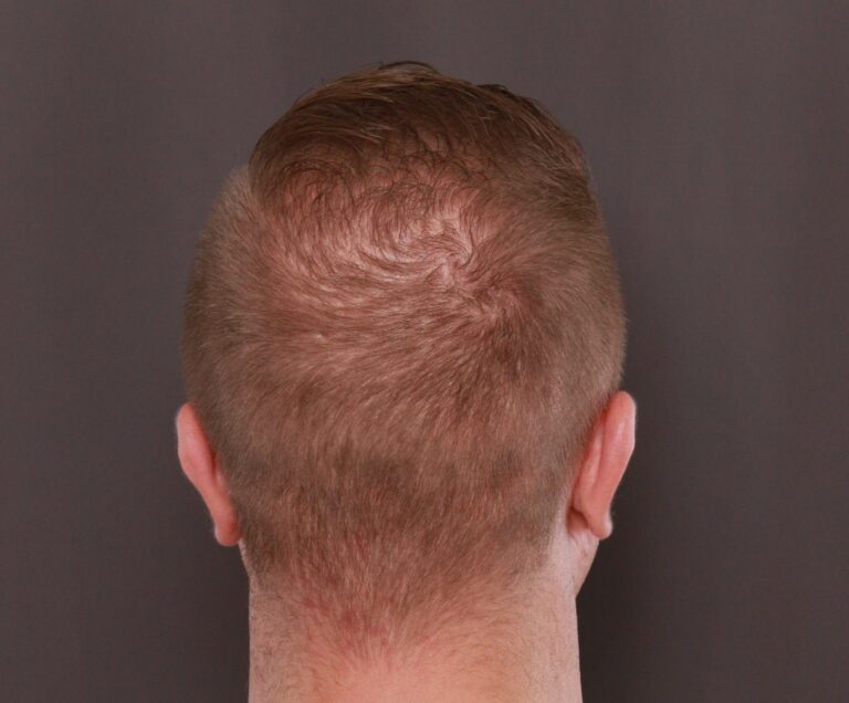 After Image