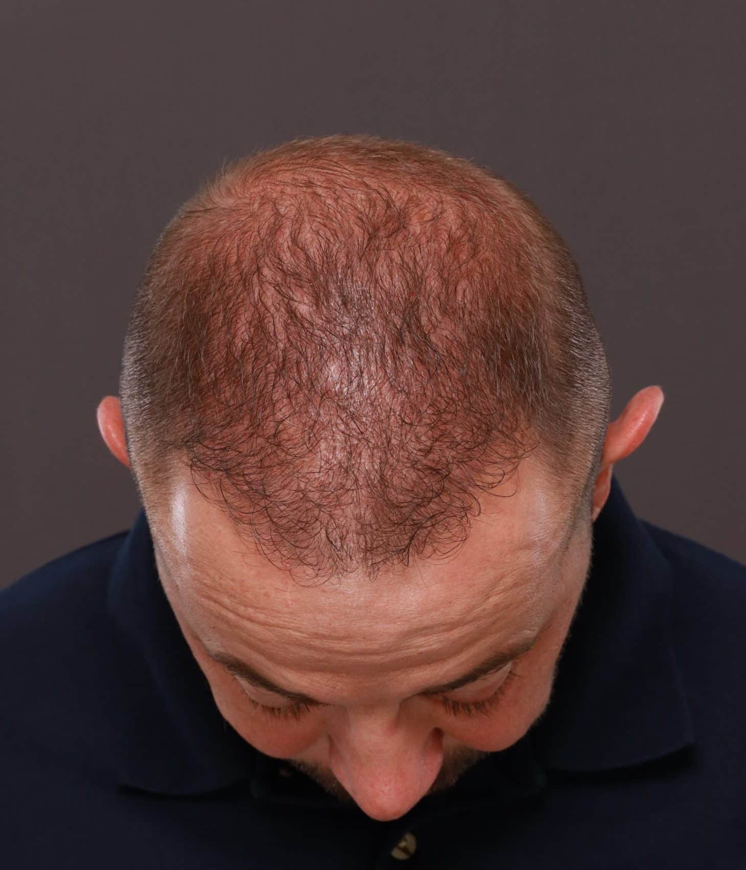 After Image