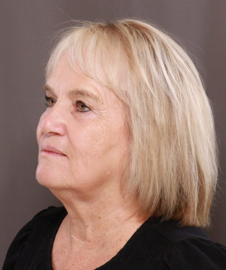 After Image: Contour TRL & BBL by Katy Larson - left-front-oblique