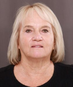 After Image: Contour TRL & BBL by Katy Larson