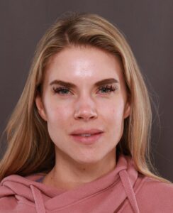 Skin Treatments & Botox