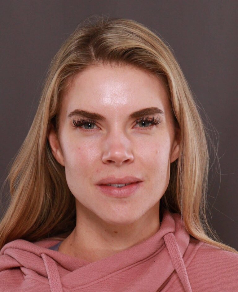 After Image