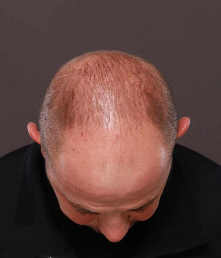 Before Image