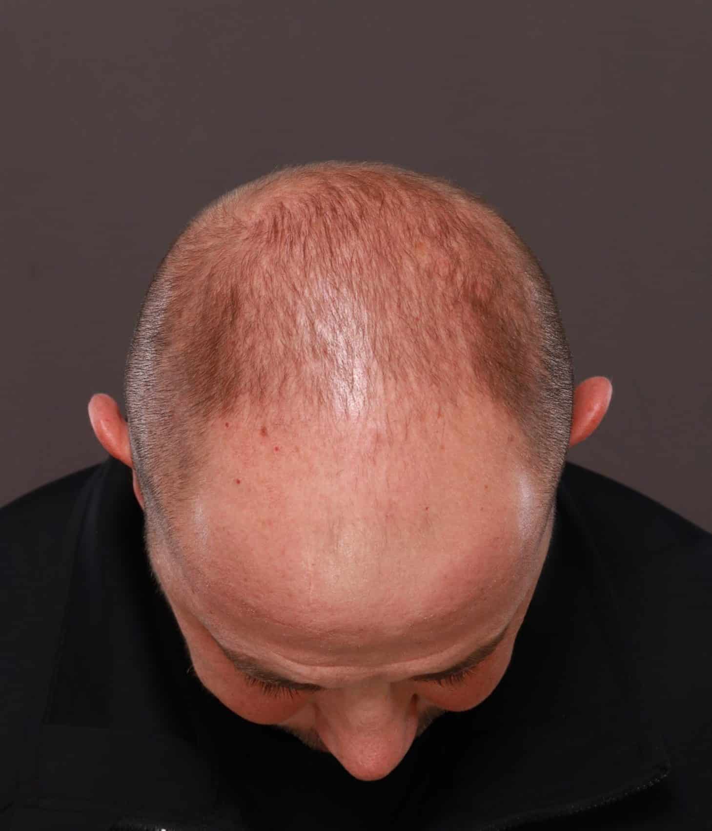 Before Image