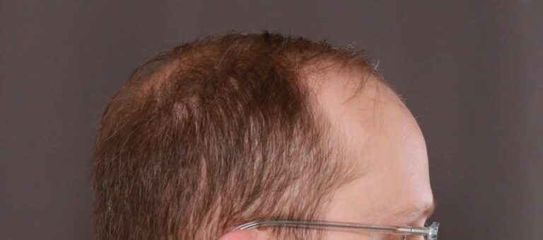 Before Image