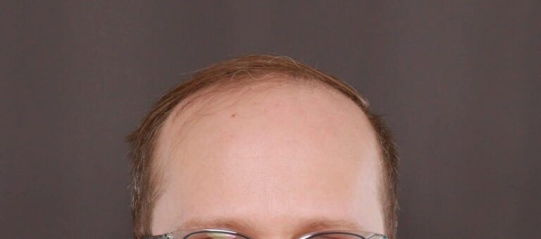 Before Image