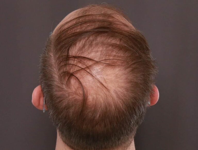 Before Image