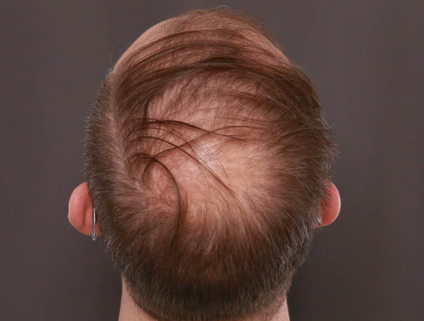 Before Image