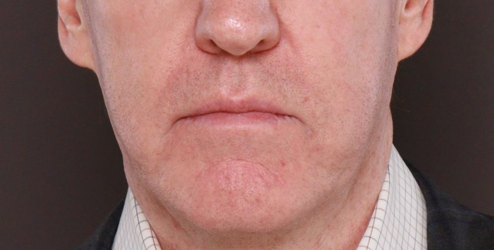 After Image