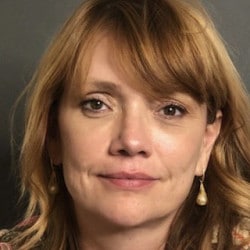 After Image: Macslift, Fat Injections, Lower Eyelids, and Septoplasty by Dr. Thompson