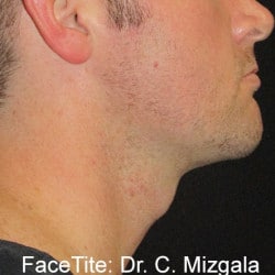 After Image