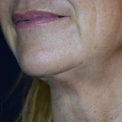 After Image
