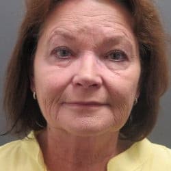 Before Image: Facelift, Orbital Fat Injections, Lower Blepharoplasty, Perioral Dermabrasion, & Chin Implant by Dr. Thompson - front