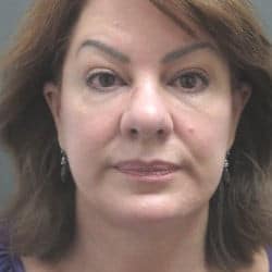 After Image: Facelift by Dr. Thompson - front