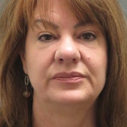 Before Image: Facelift by Dr. Thompson - front